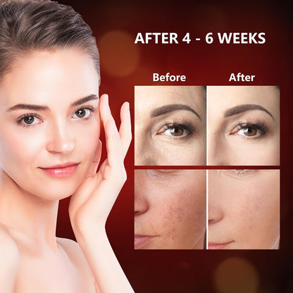 660Nm & 850Nm Red Light for Face, Soft LED Red Light Mask Face for Home Use