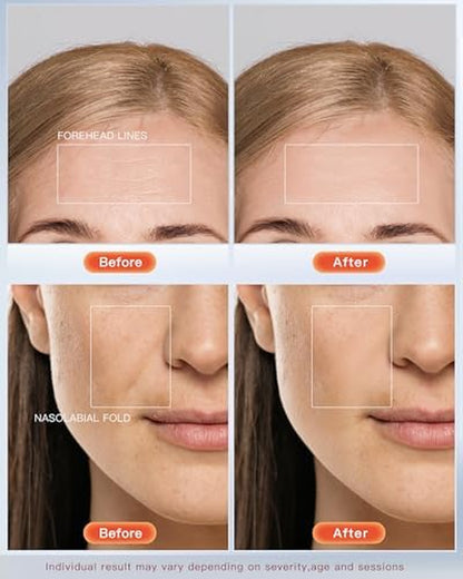 4D LED Red Light Therapy Mask for Face Skin Glowing,630Nm Led Light Therapy Face Mask anti Wrinkle, Blue Light Therapy Face Mask for Acne,Home Use,450 LED Chips,Birthday Gift,Plug In